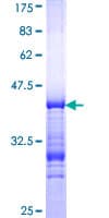 Human NCOR2 / SMRT Protein (Recombinant GST, N-terminus)