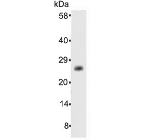 BCL2 / Bcl-2 Antibody (aa1-211)