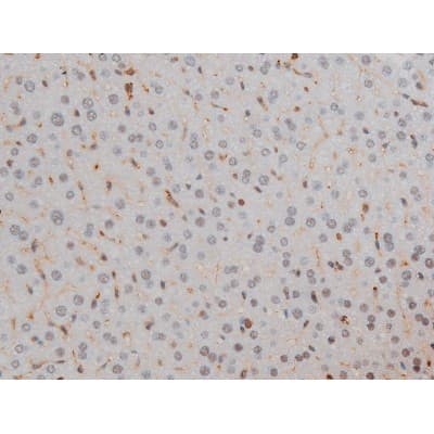 Polyclonal Rabbit anti-Human FLNA / Filamin A Antibody (phospho-Ser2152, IHC, IF, WB)