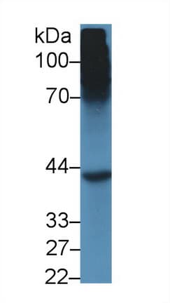 SHBG Antibody (aa219-358)