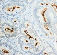 CEA / Carcinoembryonic Antigen Antibody (clone CEA-9, Sepharose)