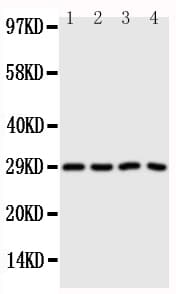 CA3 / Carbonic Anhydrase III Antibody (aa2-20)