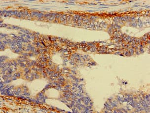 RPS5 / Ribosomal Protein S5 Antibody