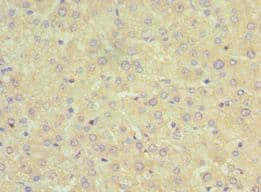 SRI / Sorcin Antibody (aa1-198)