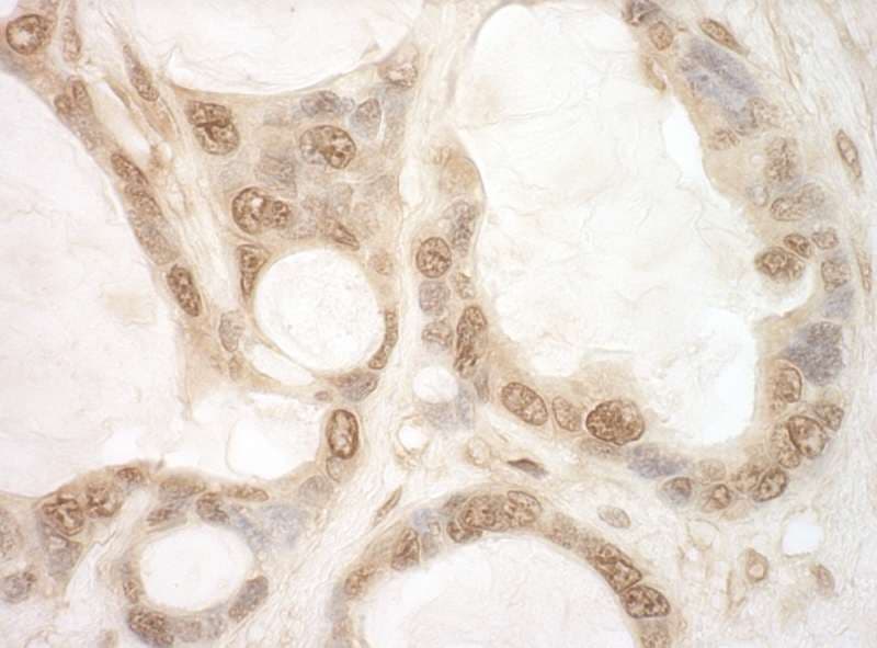 EIF2B5 Antibody (aa550-600)
