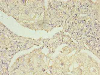 EBP Antibody (aa2-230)