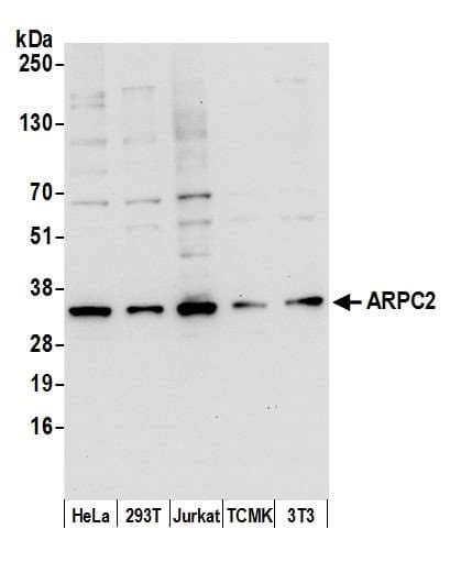 ARPC2 / p34-Arc Antibody (aa175-225)