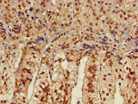 CACNB4 Antibody