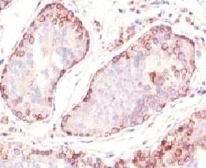 MAGEA1 / MAGE 1 Antibody (clone MZ2E/838)
