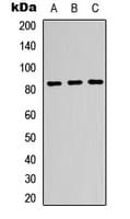 GUSB / Beta Glucuronidase Antibody (Internal)