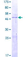 Human CCBE1 Protein (Recombinant GST)