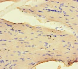 NRP2 / Neuropilin 2 Antibody