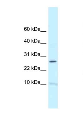 Polyclonal Rabbit anti-Human RPL39 / Ribosomal Protein L39 Antibody (C-Terminus, WB)
