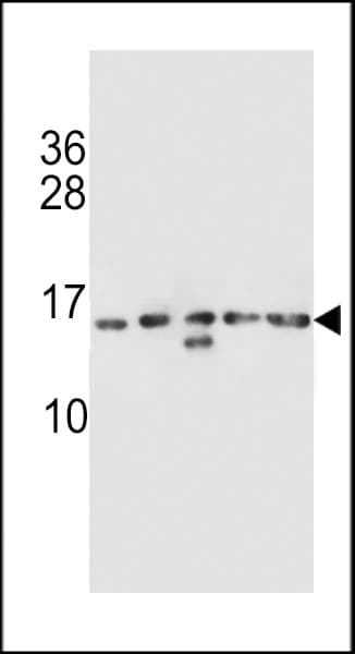 Polyclonal Rabbit anti-Human HIST1H2AB Antibody (aa12-40, IHC, WB)