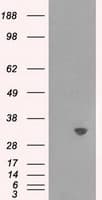 TPMT Antibody (clone OTI4C1)