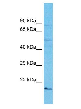 Polyclonal Rabbit anti-Human IZUMO2 Antibody (aa158-207, WB)
