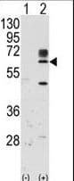 RYK Antibody (aa160-190)