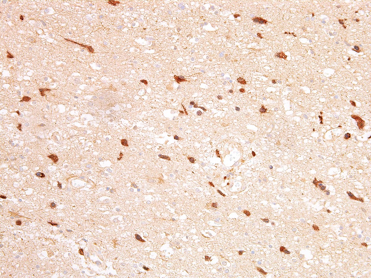 Isocitrate Dehydrogenase R132H Mutant Antibody (Ready-to-Use)