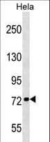 KIF3B Antibody (aa92-120)