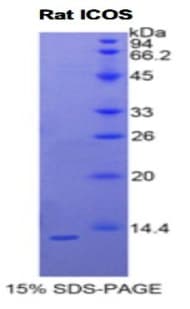 Rat ICOS / CD278 Protein (Recombinant His)