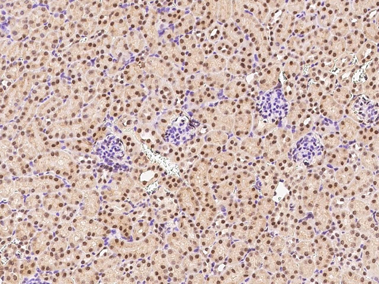 NACC1 / NAC1 Antibody (Preservative Free)