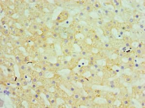 Polyclonal Rabbit anti-Human GATM / AGAT Antibody (aa124-423, IHC, WB)