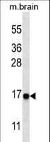 Polyclonal Rabbit anti-Human MAP1LC3A / LC3A Antibody (aa89-120, IHC, IF, WB)