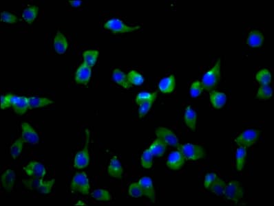 Polyclonal Rabbit anti-Human SLCO1A2 / OATP Antibody (IF)