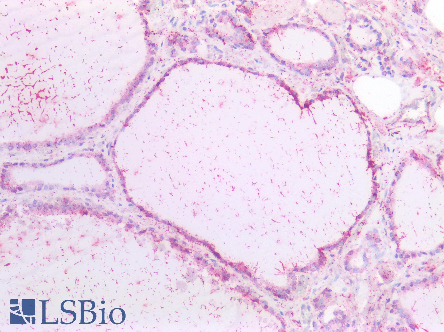IHC-plus™ CHRNA7 Antibody