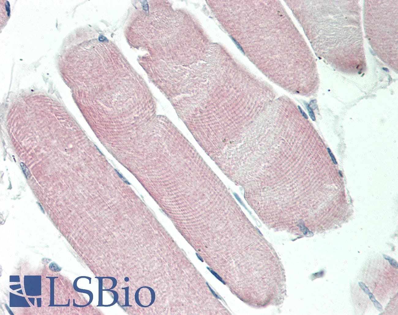 IHC-plus™ Polyclonal Rabbit anti-Human MRGPRX4 / MRGX4 Antibody (aa258-307, IHC, WB)