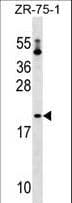 PTRH1 Antibody (aa102-129)