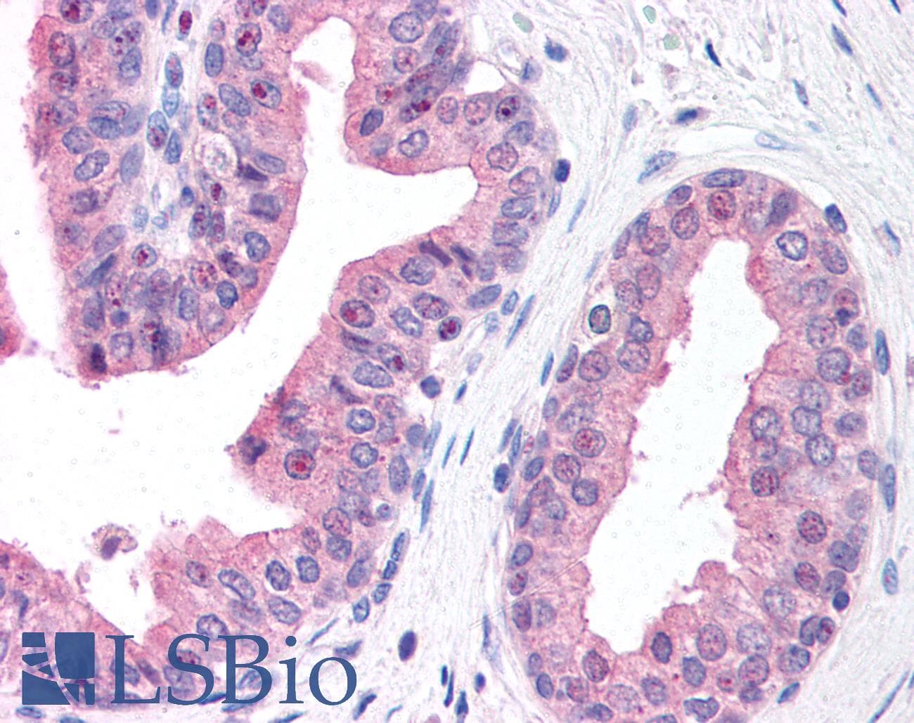 IHC-plus™ CKAP5 / ch-TOG Antibody (C-Terminus)