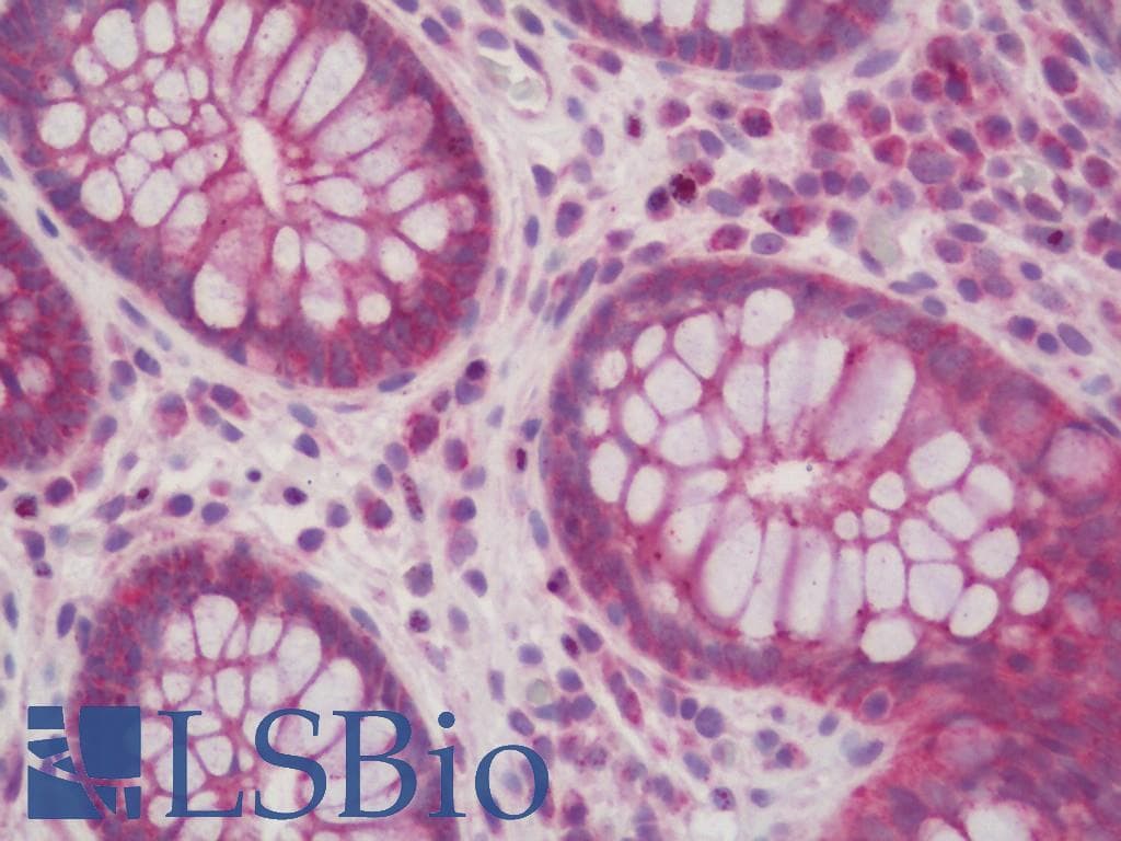 IHC-plus™ Polyclonal Rabbit anti-Human CHPF / CHSY2 Antibody (aa631-680, IHC, IF, WB)
