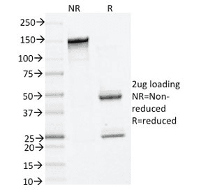 TPSAB1 / Mast Cell Tryptase Antibody (clone TPSAB1/1961)