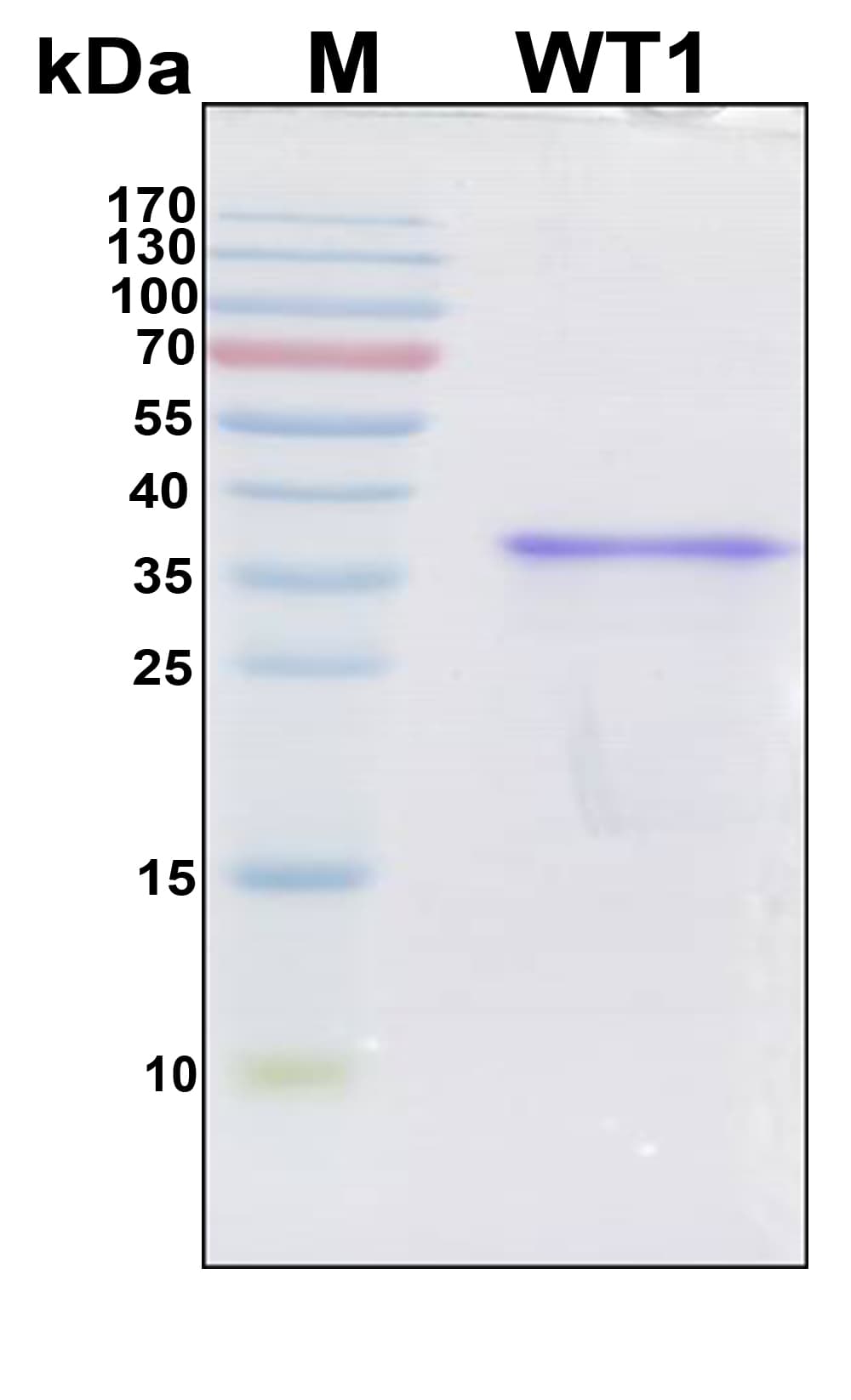 Human WT1 / Wilms Tumor 1 Protein (Recombinant 6His, N-terminus)