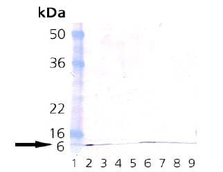 IHC-plus™ Ubiquitin Antibody (clone P4G7-H11)