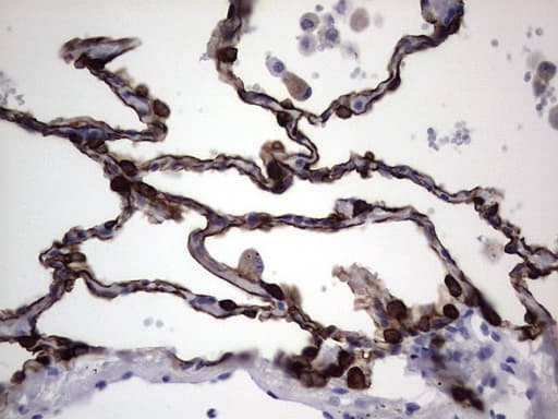 Monoclonal Mouse anti-Human KRT19 / CK19 / Cytokeratin 19 Antibody (clone OTI1E7, aa240-390, IHC)