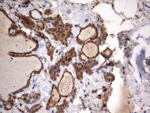 HMBS / PBGD Antibody (clone UMAB144)