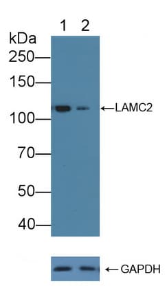 Polyclonal Rabbit anti-Human LAMC2 / Laminin Gamma 2 Antibody (aa28-196, WB)