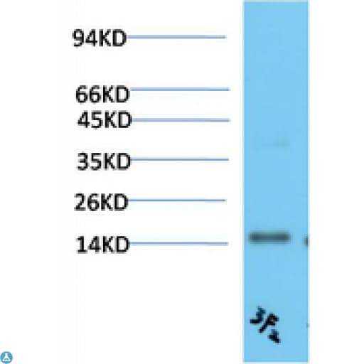 TTR / Transthyretin Antibody