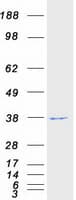 Human WDR5 Protein (Recombinant Myc-DDK (Flag))
