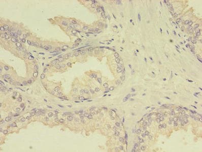 MTHFR Antibody (aa1-656)