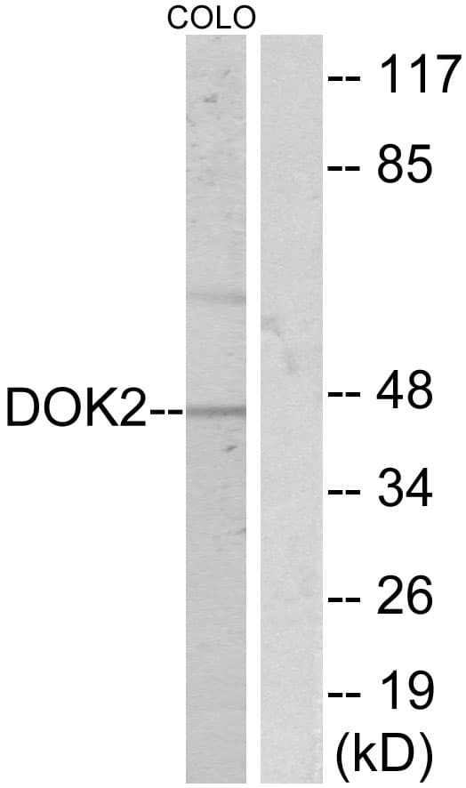 DOK2 Antibody (aa266-315)