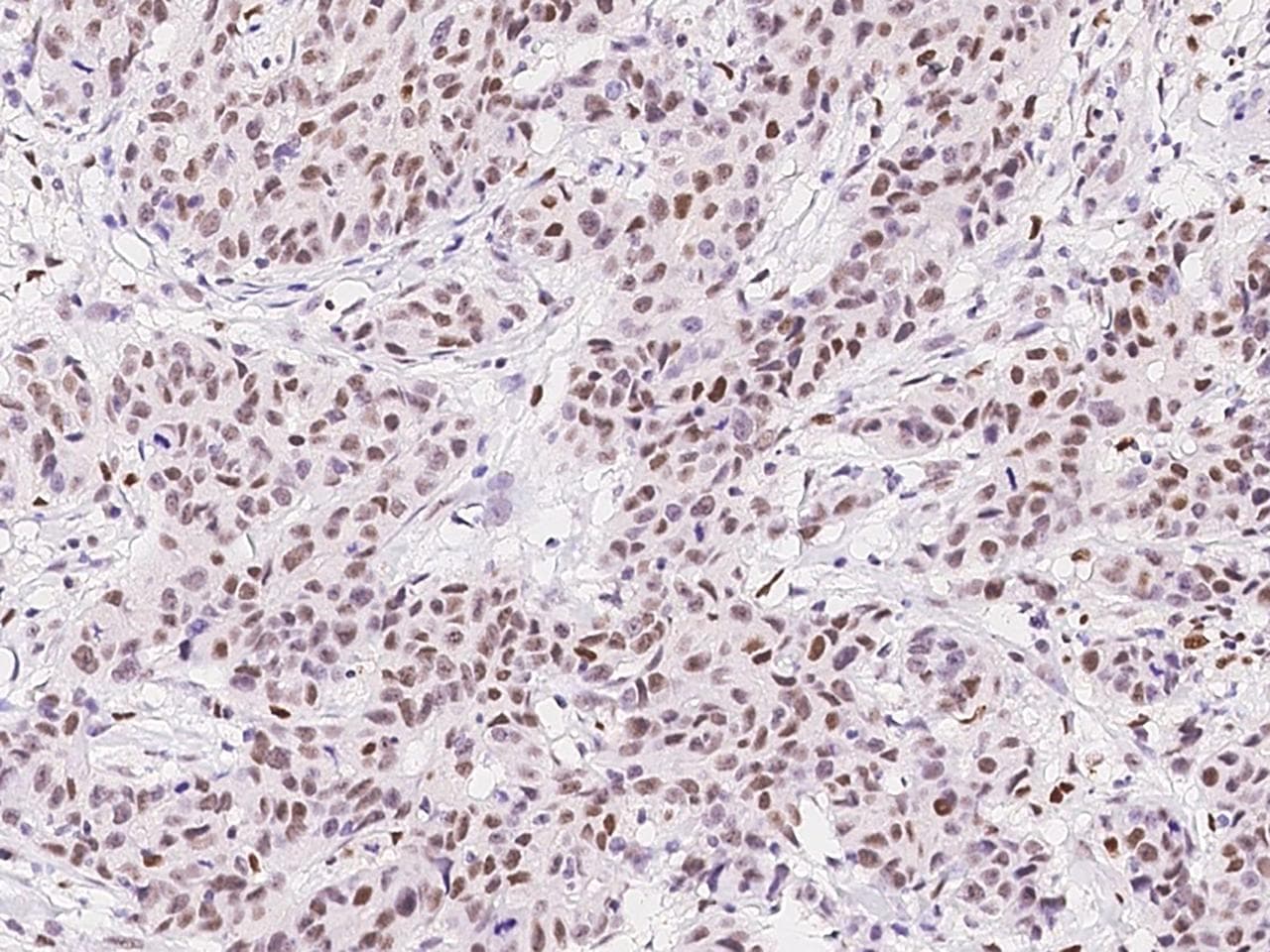 NR2C1 Antibody