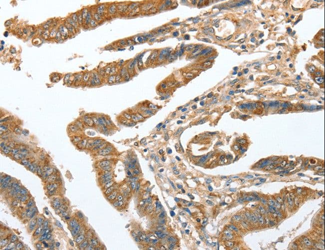 CKAP2 Antibody