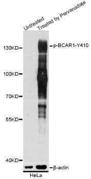 Polyclonal Rabbit anti-Human BCAR1 / p130Cas Antibody (phospho-Tyr410, WB)