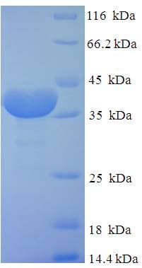 Human FKBP14 Protein (Recombinant His-SUMO)