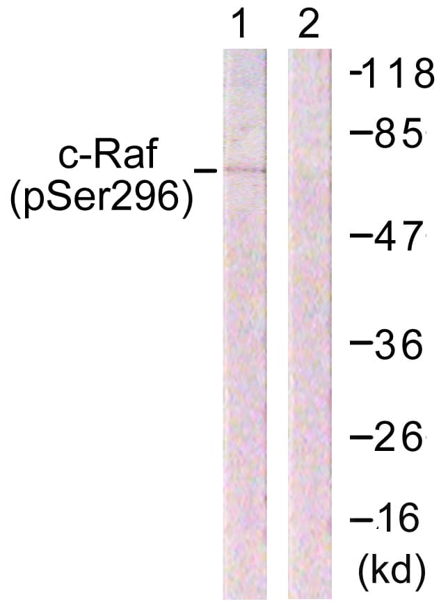 RAF1 / RAF Antibody (phospho-Ser296)