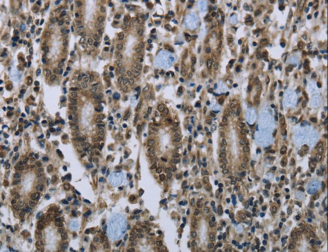 CLPS / Colipase Antibody