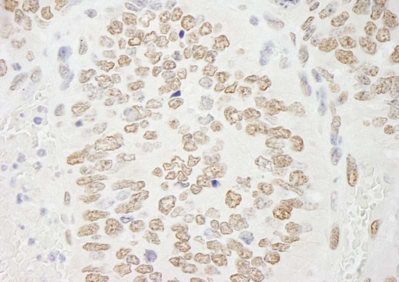 PRMT6 Antibody (aa325-C-term)
